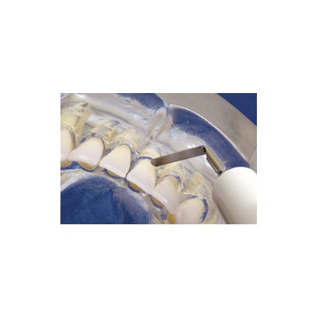 INSERT N°3 SATELEC DETARTREUR