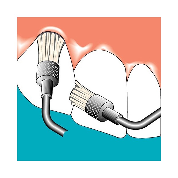 INSERT SONICFLEX CLEAN N°48 + BROSSES