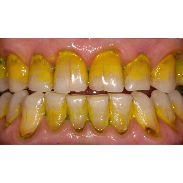 REVELATEUR DE PLAQUE F.L.A.G FOR B.LED - 100 ml