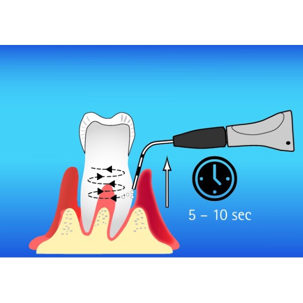 KIT PROPHYFLEX PERIO