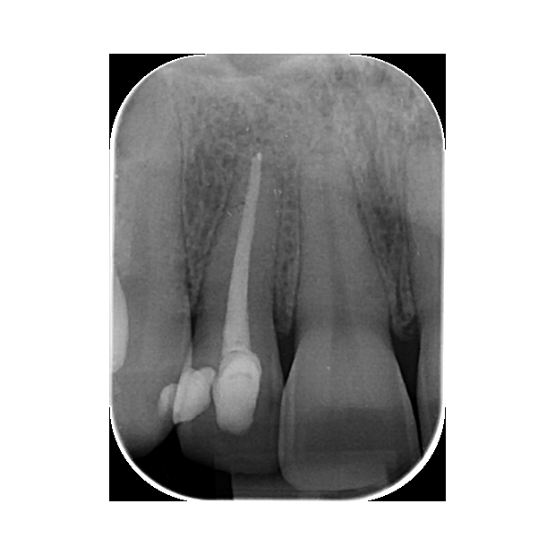 ECRAN A MEMOIRE ERLM TAILLE 0 STANDARD (x6)