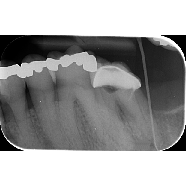 ECRAN A MEMOIRE ERLM TAILLE 1 STANDARD (x6)