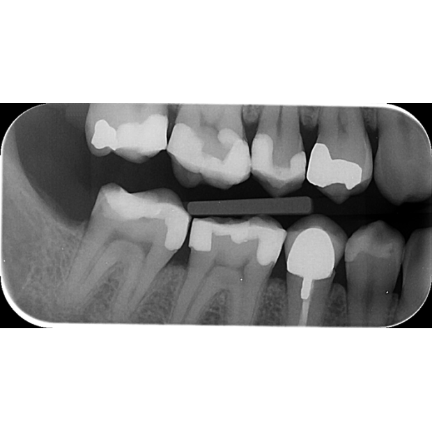 ECRAN A MEMOIRE ERLM TAILLE 3 STANDARD (x6)