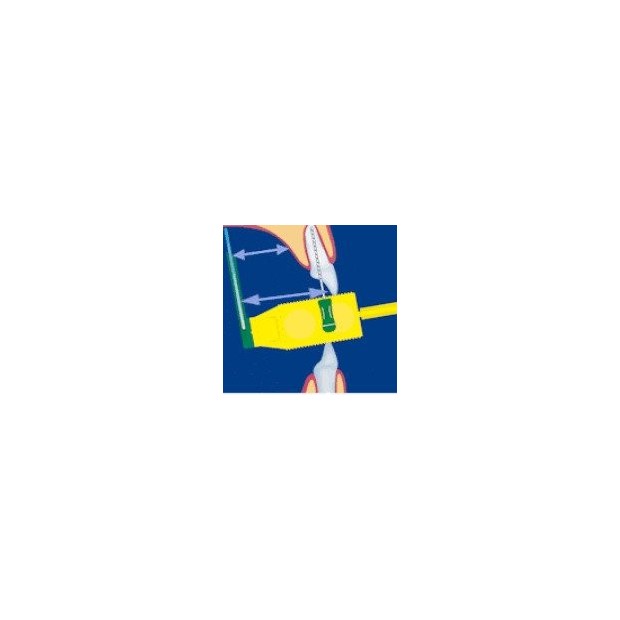 Assortiment d'angulateur Endo Bite (2 post. +2 ant.)