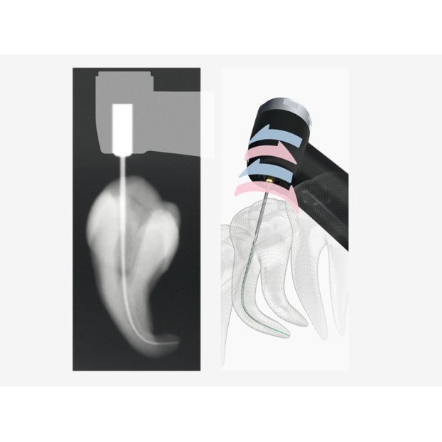 TRI AUTO ZX2 - Contre angle d'endo sans fil avec localisateur d'apex.