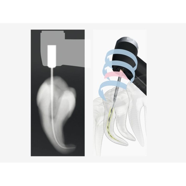 TRI AUTO ZX2 - Contre angle d'endo sans fil avec localisateur d'apex.