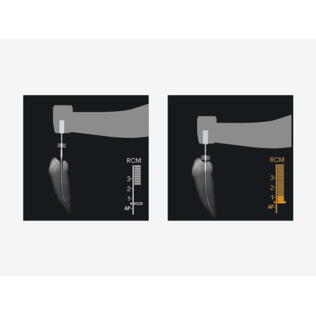 TRI AUTO ZX2 - Contre angle d'endo sans fil avec localisateur d'apex.