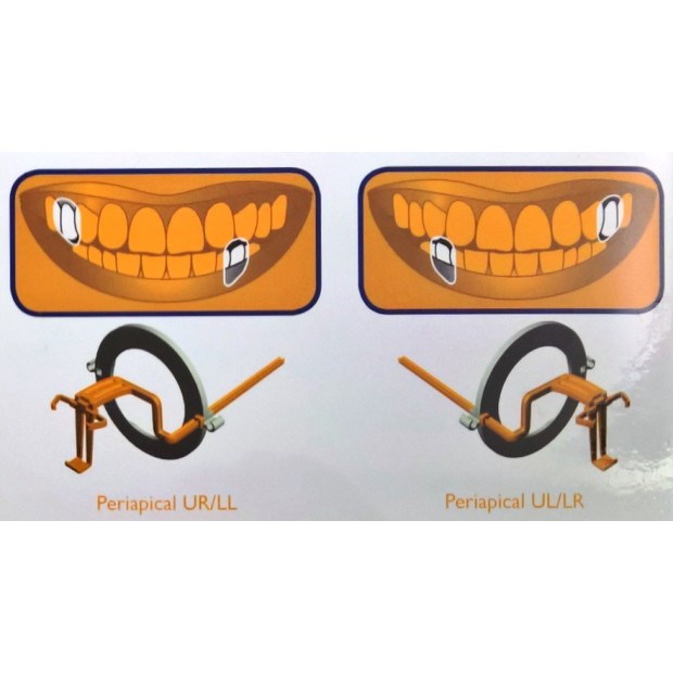 Kit de 10 angulateurs plastique Periapical (orange) Taille 2