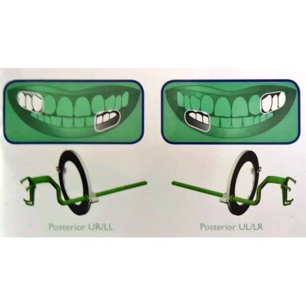 Kit de 10 angulateurs plastique Postérieur (vert) Taille 2