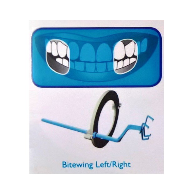 Kit de 10 angulateurs plastique Bitewing (bleu) Taille 1