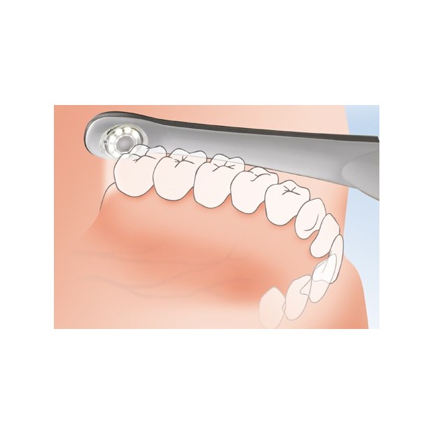SOPRO 617 - CAMERA INTRA ORALE